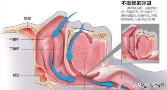 关于六个月宝宝嗓子呼噜响的探讨