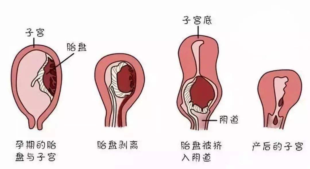 全切子宫后两个月同房，恢复与注意事项